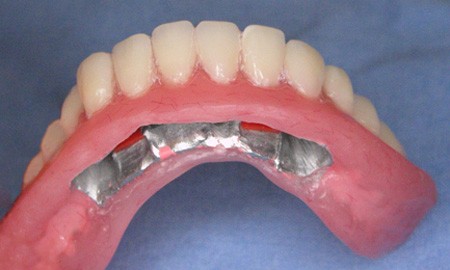 Bezzębna żuchwa - Plastikowy Model 02