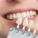 Licówki dentystyczne do obudowy uzębienia