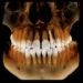 Zastosowanie technologii CBCT w planowaniu zabiegów chirurgicznych