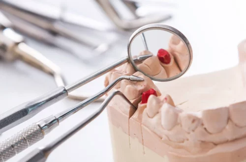 Czym jest periodontologia i dlaczego jest ważna?