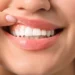 Odbudowa tkanek miękkich wokół implantów
