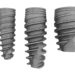 Kształt implantów stomatologicznych - stożek, cylinder, spirala. Który wybrać?