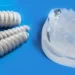 Implanty dwufazowe w Sanadent Stomatologia
