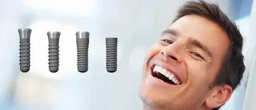 Wielkość implantu dentystycznego - dobór w stomatologia Sanadent Szczecin