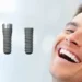 Wielkość implantu dentystycznego - dobór w stomatologia Sanadent Szczecin